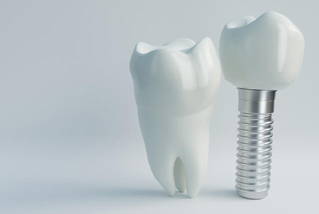 インプラントの模型