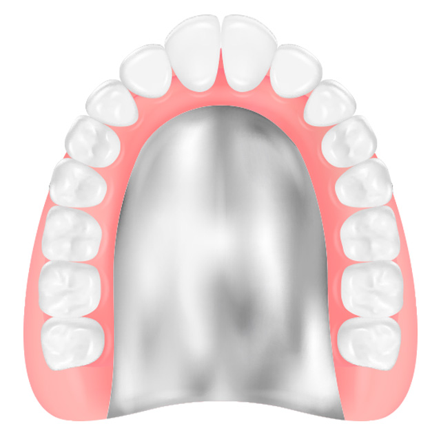 チタン床義歯／コバルトクロム床義歯のイラスト