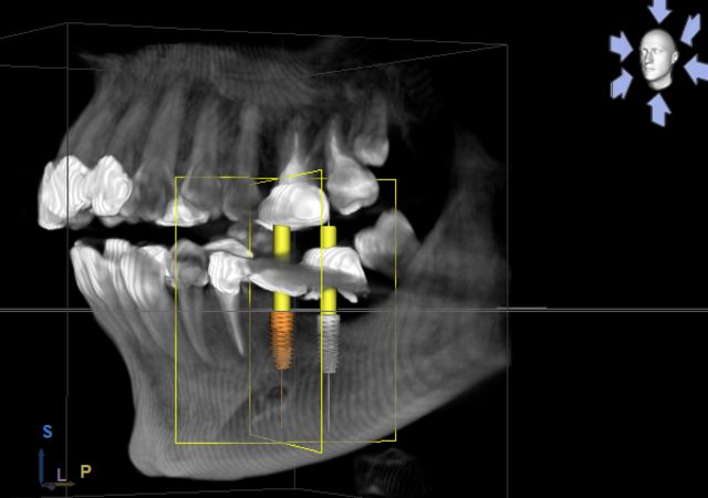 CT・3Dスキャナー